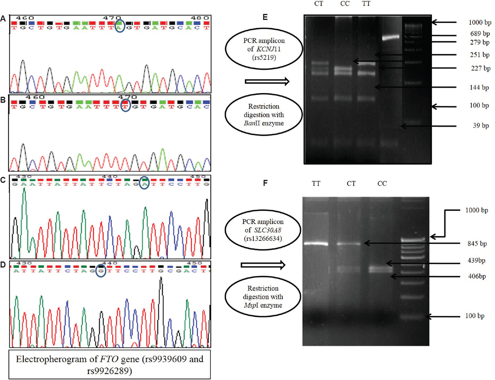Chromatogram depicting FTO SNPs [rs9939609: (A) wild type, (B) homozygote]; [rs9926289: (C) wild type, (D) homozygote] and restriction digestion patterns in KCNJ11 (E) and SLC30A8 (F). FTO, fat mass and obesity associated; KCNJ11, potassium voltage-gated channel subfamily J member 11; SNPs, single nucleotide polymorphisms.