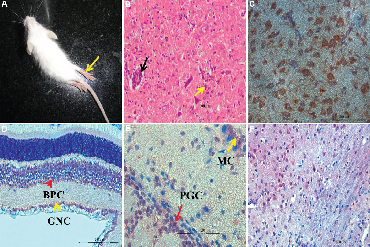 (A) Japanese encephalitis virus (JEV) infected mice showing fur ruffling and hind limb paralysis. (B) perivascular cuffing (black arrow) and gliosis (yellow arrow) in brainstem (H and E, ×200). (C) JEV antigen (reddish brown) in the cytoplasm of neuronal cells of cerebrum (IHC, ×400). (D) JEV antigen in the bipolar cells (BPC) of inner nuclear layer and ganglion cells (GC) of retina (IHC, ×400). (E) JEV antigen in the mitral cells (MC) and periglomerular cells (PGC) of olfactory bulb (IHC, ×400). (F) JEV antigen (reddish brown) in the cytoplasm of neuronal cells in pons (IHC, ×400).