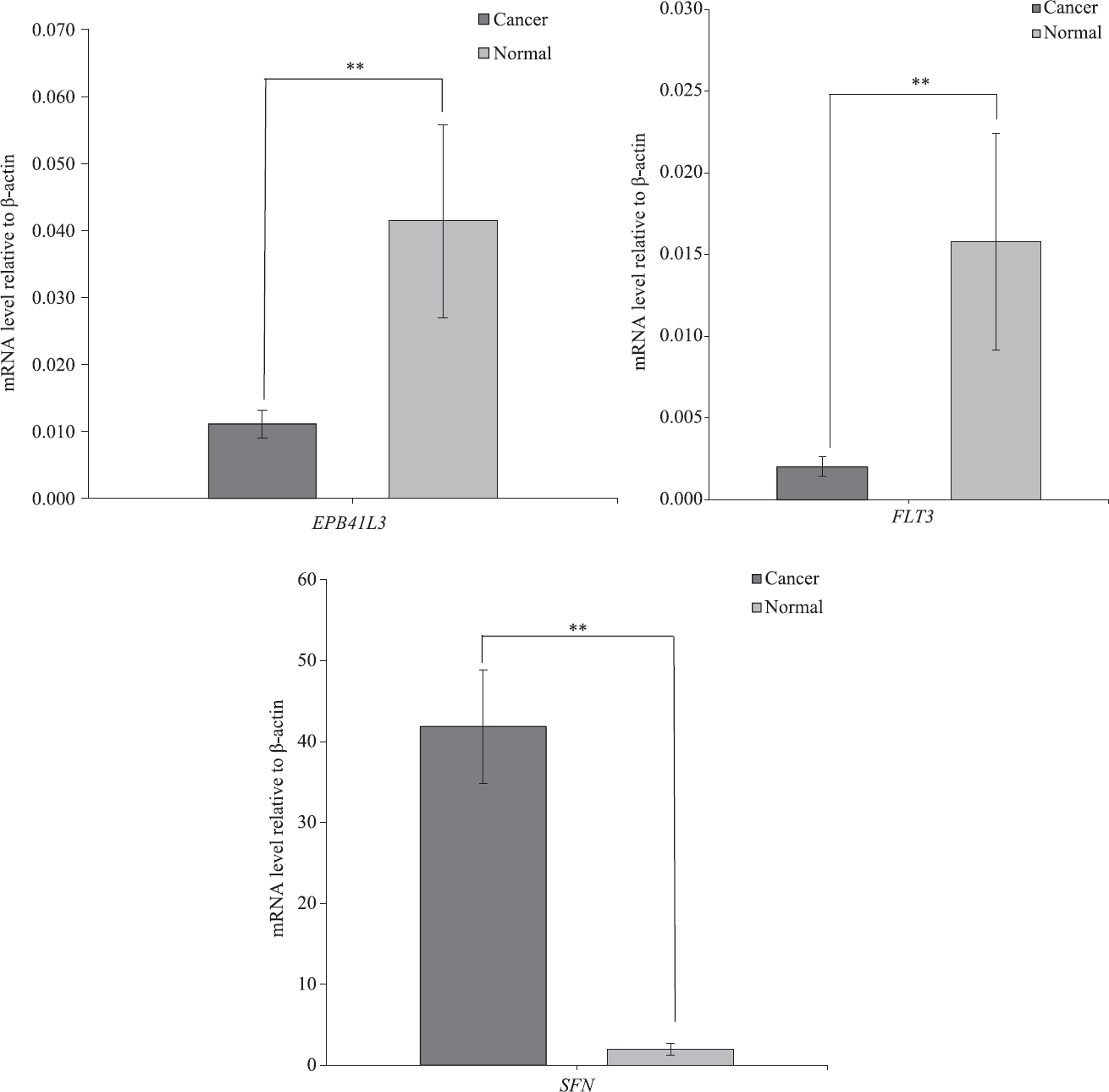 Average mRNA expression of FMS-related tyrosine kinase 3 (FLT3), erythrocyte membrane protein band 4.1 like-3 (EBP41L3) and stratifin (SFN). Real-time polymerase chain reaction was performed to identify the mRNA expression of all three genes in tumour and adjacent paired normal tissues (n=12). **P<0.01 compared to normal. Data are shown as mean±standard error of mean.