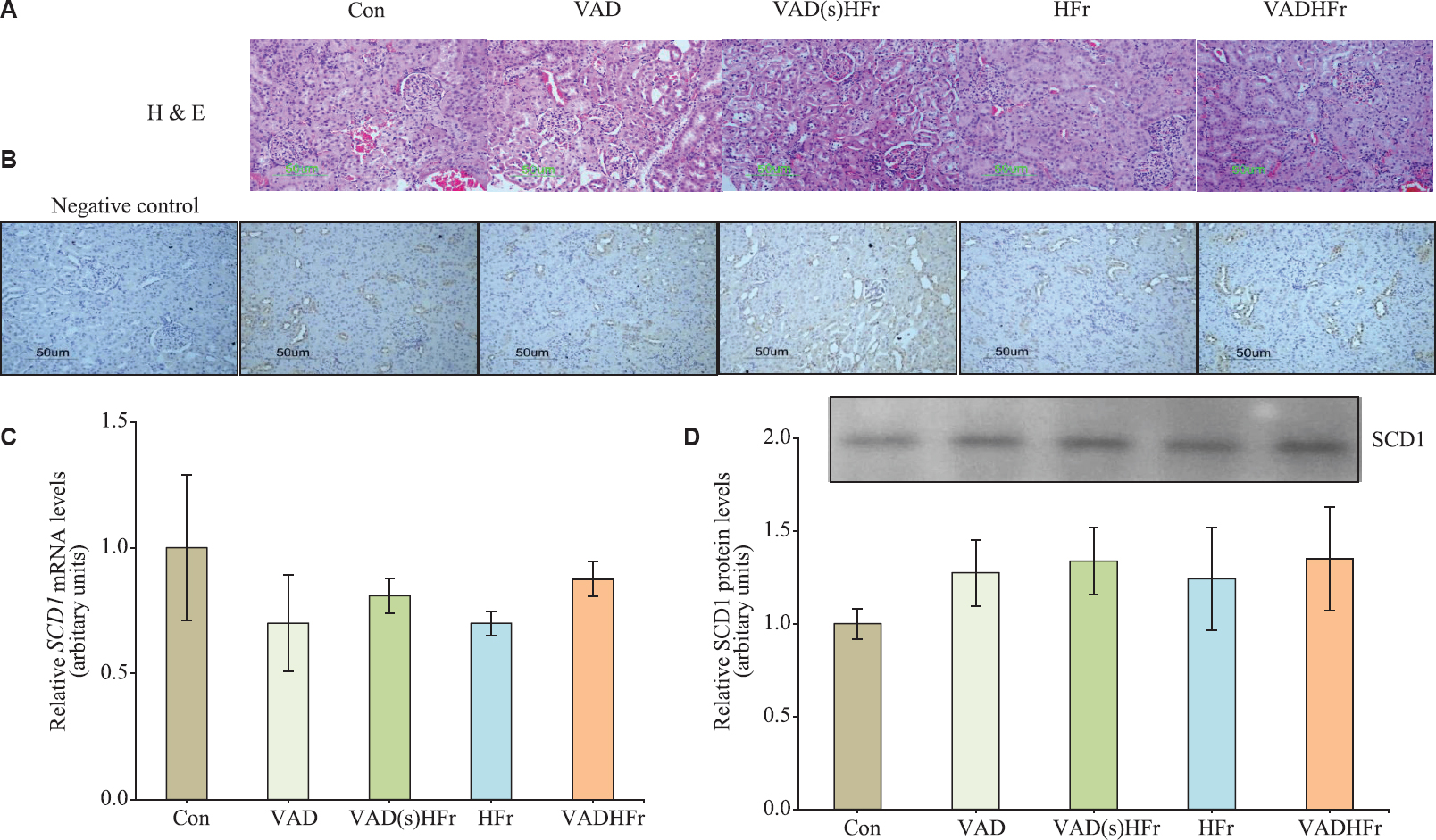 Impact of vitamin A-deficient diet on kidney stearoyl-CoA desaturase 1 (SCD1) expression. (A) Representative photomicrographs of histology sections of kidney stained with H and E, (B) immunohistological staining of kidney SCD1, and (C and D) expression levels of SCD1 for mRNA and protein (Representative immunoprecipitated-immunoblot) with densitometry analysis, respectively. Values are expressed as means±SEM of 4-5 rats from each group. Data were analyzed by one-way ANOVA with the post hoc Tukey's test. Photomicrographs were taken at ×20 using Nikon-Eclipse E800 microscope. Different diets as given in Fig. 1 legend.
