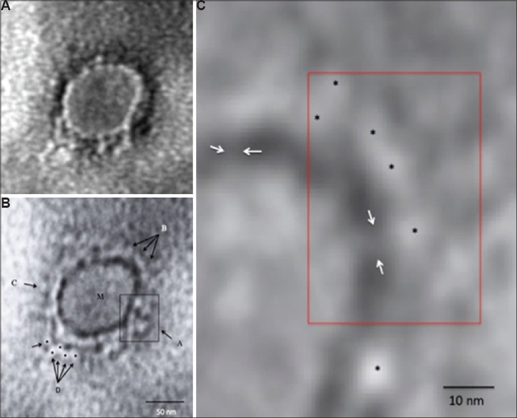 Transmission electron microscopy imaging of COVID-19. (A) A representative negative-stained COVID-19 particle showing morphodiagnostic features of family Coronaviridae. (B) Defocussed image of the same particle resolving the virus envelope glycoprotein morphology in finer details. The boxed area A shows a tetramer-like aggregate of four distinct peplomers, arrows shown by B show a more orthodox morphology of coronavirus surface projections. M indicates the matrix of the virus particle. C shows a distinct 'peplomer head' with negative stain silhouette. The area D is interesting as possible linear projections could be imaged. Five distinct peplomers could be imaged as shown by the arrows. (C) A highly magnified processed image for pixel corrections shows a distinct evidence of direct 'stalk' connecting the peplomer to the virion surface. The peplomers are shown with asterisk and the stalk with an arrow. Magnification bars are built into the micrographs.