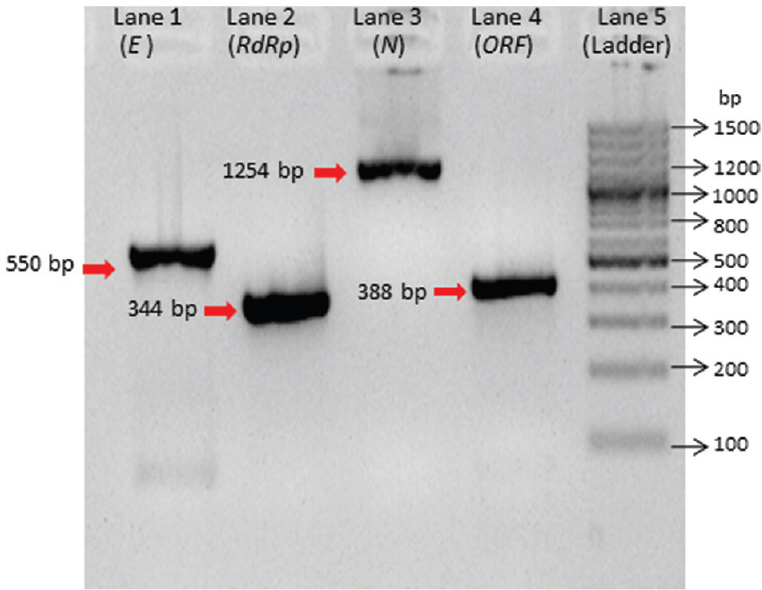 Positive DNA amplification of envelope (E), RNA-dependent RNA polymerase (RdRp), nucleocapsid (N) and open reading frame (ORF) 1b-nsp14 for in vitro transcribed preparation. Lane 1: E gene (550 bp), lane 2: RdRp gene (344 bp), lane 3: N gene (1254 bp) positive, lane 4: ORF (388 bp), lane 5: 100 bp DNA ladder.