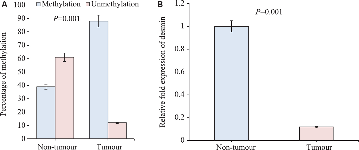 (A) Histogram showing statistical difference in methylation in tumours and non-tumours. (B) Relative fold change of desmin RNA expression by real-time polymerase chain reaction in gall bladder tumours and non-tumours. Fold change in tumour tissue normalized to non-tumour after subtracting the control 18S rRNA Ct values.