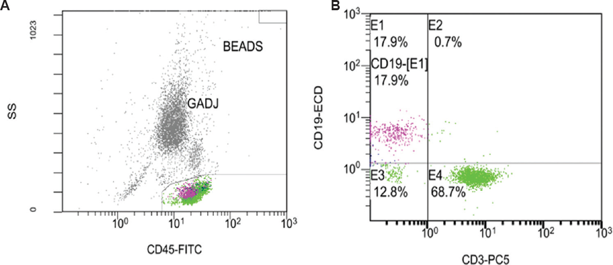 A representative flow cytometric dot plot of CD19+ and CD3+ cell subsets expression in rheumatoid arthritis patients. (A) CD45+ cells (general leukocyte marker) of the peripheral blood sample were gated in CD45-FITC vs. side light scatter (SS) dot plot. (B) CD3-PC5 vs. CD19-ECD cellular expression was then gated to differentiate CD3+ T cell (E4) and CD19+ B cell (E1) population. GADJ, gate adjust.