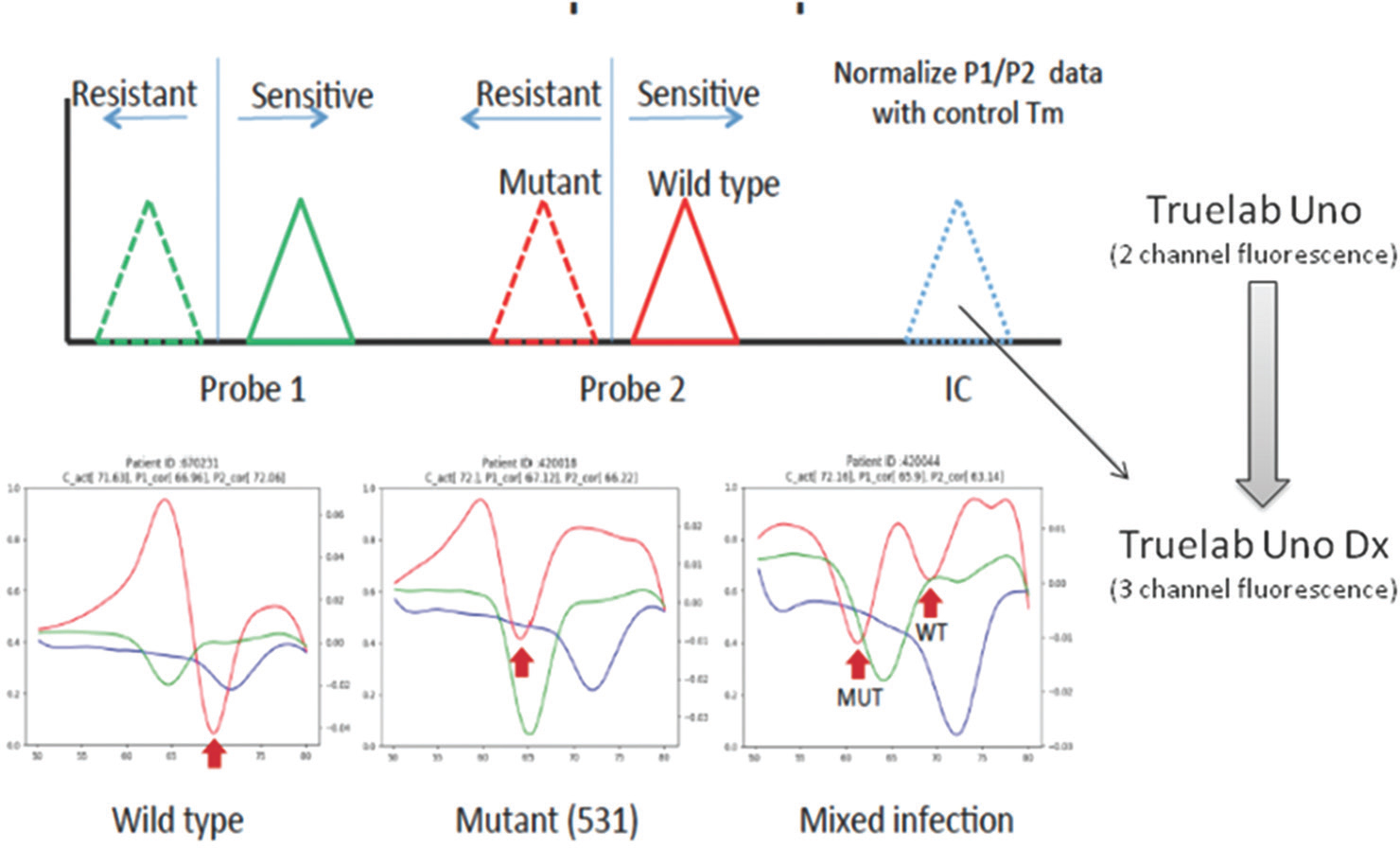 Differences in Truenat Versions 1.5 and 2.0: Inclusion of internal control and third wavelength in Version 2.0 enabled better distinction between rifampicin sensitive and resistant Mycobacterium tuberculosis.