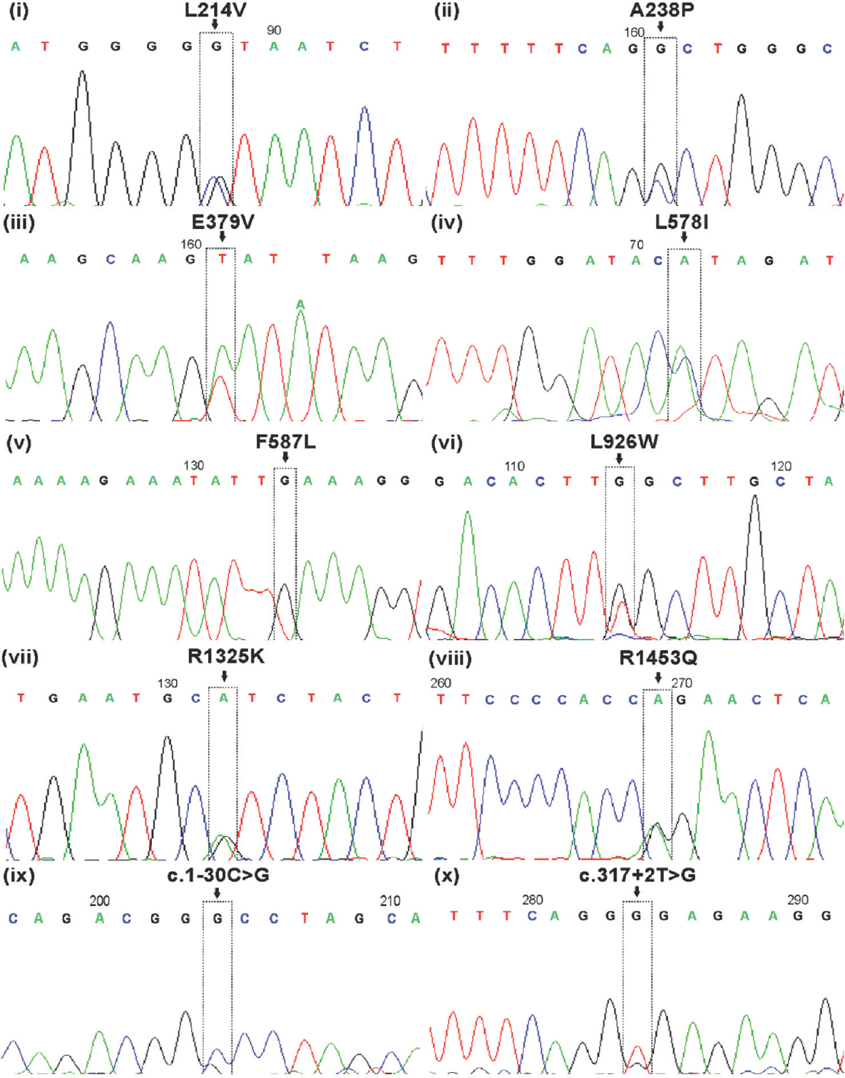 Sequencing results of novel CFTR gene variants (L214V, A238P, E379V, L578I, F587L, L926W, R1325K, R1453Q, c.1-30C>G and c.317+2T>G) identified in Indian congenital bilateral absence of vas deferens men.