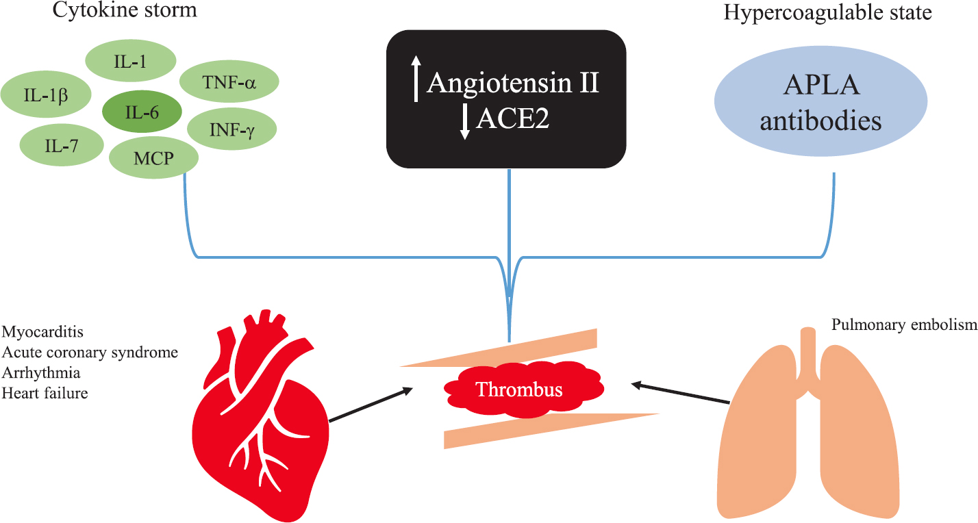 The proposed mechanism of cardiovascular manifestations of COVID-19. Hyperinflammatory state secondary to cytokine storm, increased angiotensin II, low ACE2 levels and APLA contribute to thrombus formation in coronary and pulmonary vasculature. APLA, antiphospholipid antibodies; IL, interleukin; IFN-γ, interferon-gamma; MCP, monocyte chemoattractant protein; TNF-α, tumour necrosis factor-alpha. Source: Refs 2425.