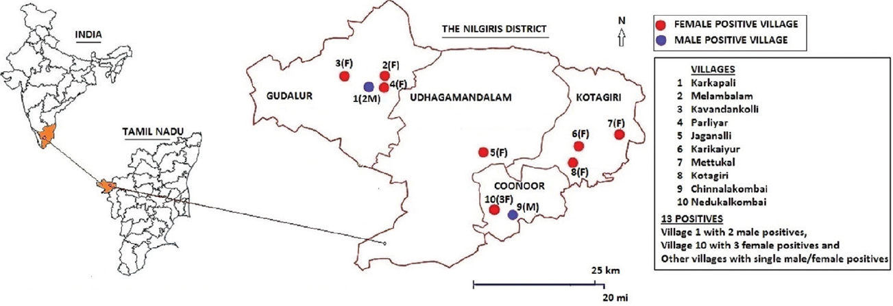 Study sites in the Nilgiris district, Tamil Nadu. Source: https://www.cdc.gov › epiinfo. Map generated in English (US ) 7.2.3.1 version of EPI INFO TM Website (CDC, Atlanta, USA)