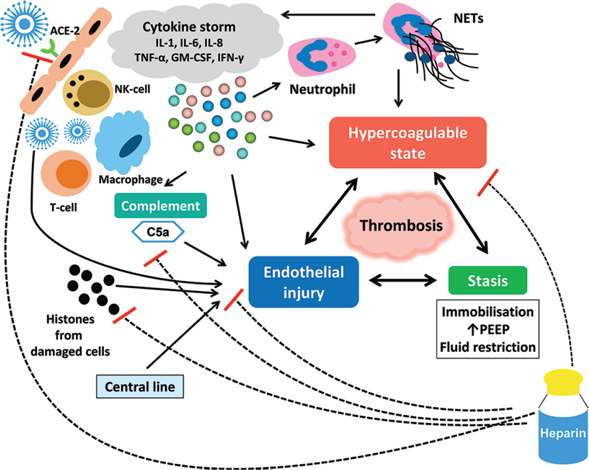 Pathogenesis of COVID-19–associated coagulopathy. The S1 subunit of Spike ‘S’ protein on the surface of SARS-CoV-2 virus engages with membrane-bound cellular receptor carboxypeptidase ACE2 presents over the cell membrane of lung epithelial cells (pulmonary alveolar type II cells). S2 subunit stalk mediates cellular binding of SARS-CoV-2. After entry, virus replicates and causes cytokine storm, complement activation, activation of macrophages, T-cells, NK-cells, neutrophils; and increase in angiotensin II levels. Direct viral injury, complement activation, histones from damaged cells and raised angiotensin II levels collectively produce endothelial injury. Cytokine storm, complement activation, antiphospholipid antibodies and NETs create hypercoagulable state in COVID-19. Furthermore, immobilization, raised PEEP and fluid restriction produce stasis, and completes the Virchow's triad of thrombosis. The positive effect of heparin is multifactorial. Heparin prevents both endothelial injury and thrombus formation in COVID-19. Black arrows indicate upregulation, and dotted lines with red bar indicate downregulation. ACE2, angiotensin converting enzyme 2; APLA, antiphospholipid antibody; GM-CSF, granulocyte monocyte colony stimulating factor; IL, Interleukin; INF-γ, Interferon-γ; NK cell, natural killer cell; NETs, neutrophils extracellular traps; PEEP, positive end expiratory pressure; TNF-α, tumour necrosis factor-a.