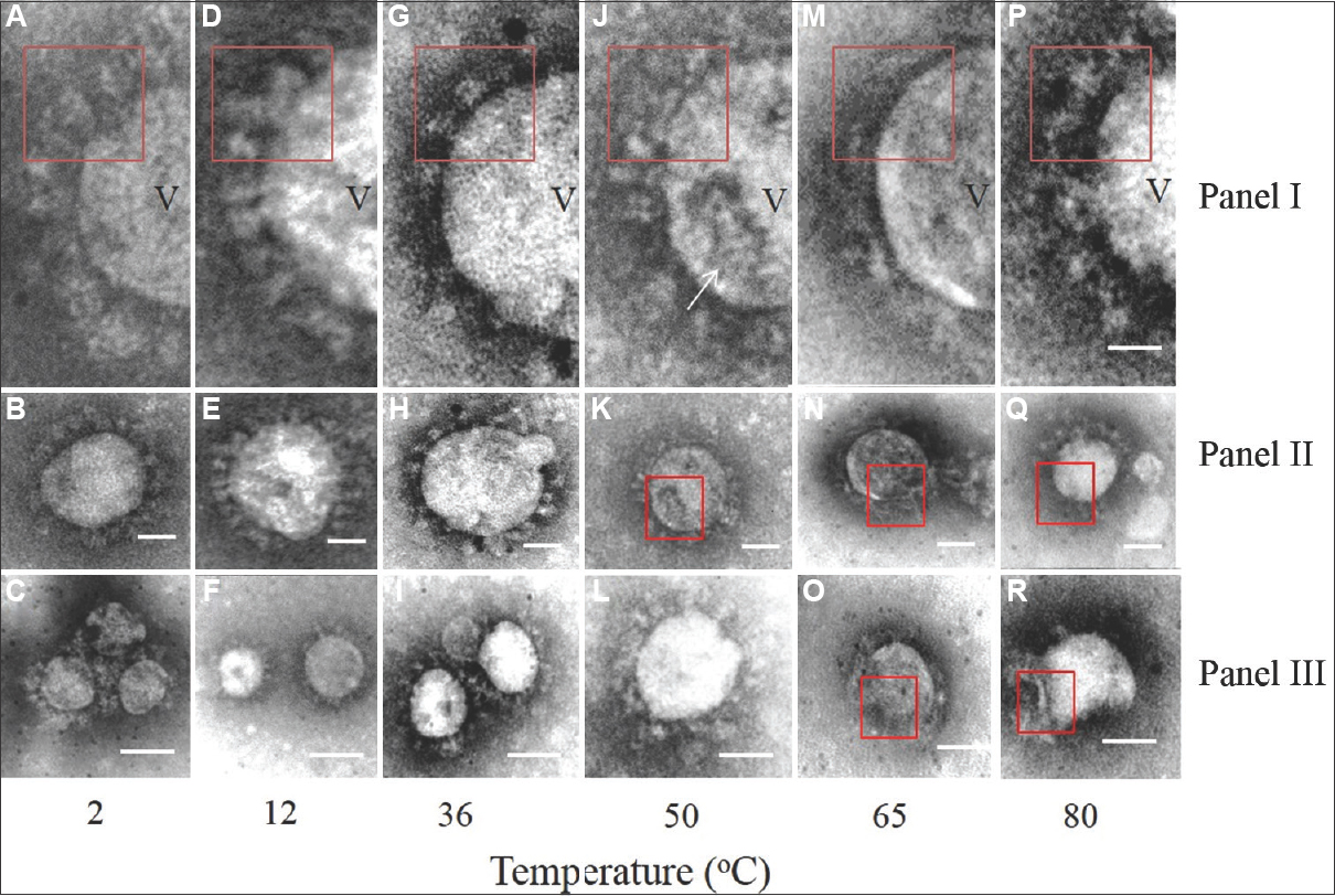 Representative transmission electron microscopy images of the SARS-CoV-2 at different temperatures. Panel I shows the highly magnified images of the envelope glycoprotein projections from selective areas of the virus particles shown in Panel II. Panel C shows representative images from other fields at respective temperature treatment points. (A-C) Images of virus particles treated at 2°C. The envelope spike glycoprotein was prominent as shown in red box outline (A) (D-F) images of virus treated at 12°C. Variation in particle size shown in (F) and distinct envelope projection (D) representative intact virus particles treated at 36°C are shown in (I) with distinct club-shaped terminal knob of the envelope projection shown in red box inset (G). Single virus particles at 36°C and 50°C with intact envelope projections are shown in (H) and (L) respectively. Treatment at 50°C increased the proportion of damaged particles majority of which showed collapsed surfaces (K) and disorganized envelope (J). At 65°C and 80°C, the virus particles were damaged (O,N,R). However, some intact particles were observed (Q). The envelope projections at these temperatures were significantly disorganized in Panel I (M, P). The magnification bar in Panel I, II is 20 nm and in Panel III it is 100 nm. In Panel I, V represents SARS-CoV-2 virion particle; the arrow indicates presence of “moth eaten appearance” on virion particles when subjected to higher temperature.