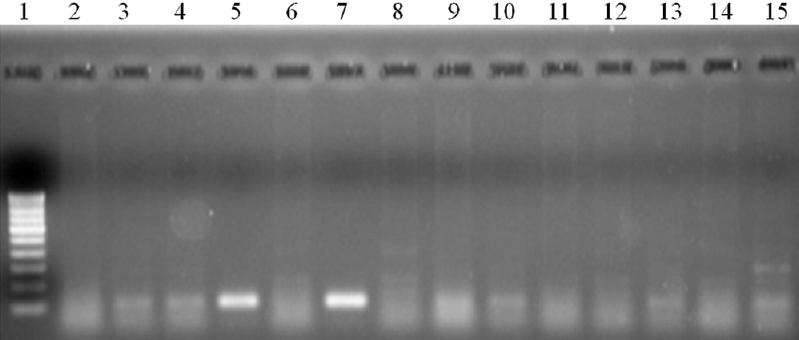 Stage specificity of L3-specific RT-PCR in detecting the infective stage W. bancrofti in pools of mosquitoes containing mixed stages of W. bancrofti in Cx. quinquefasciatus . Lane 1- Molecular weight marker (100 bp); lanes 2, 6, 8, 11, 12, 14 – mosquito pools with mixed stages without L3; lanes 3, 4, 5, 7, 9, 10, 13, 15 – Mosquito pools with mixed stages including L3.