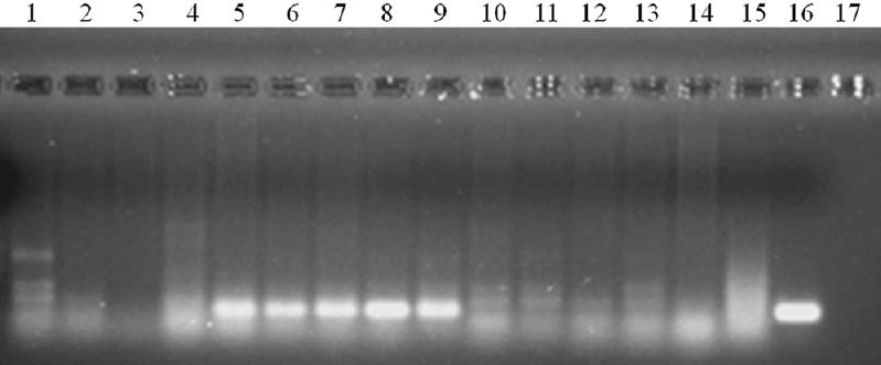Specificity and sensitivity of L3-specific RT-PCR in detecting the infective stage W. bancrofti in Cx. quinquefasciatus by the participant. Lane 1: Molecular weight marker (100 bp); lanes 2, 3, 4; pools containing Mf, L1, L2; lanes 5-10: pools containing L3 larvae; lanes 11-15: pools without L3; lane 16: positive control (L3 larvae; lanes 17: negative control (mosquito).