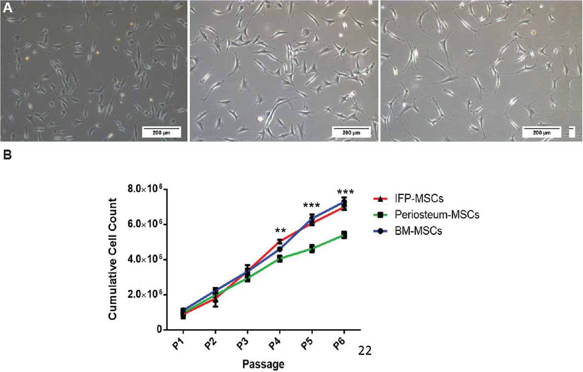 Morphology and proliferation potential of mesenchymal stem cells (MSCs) from three tissues. (A) Phase-contrast microscopic images (×10 magnification) of bone marrow (BM)- MSCs, infrapatellar fat pad (IFP)- MSCs and periosteum (P) - MSCs at day one after the first passage showing similar multipolar elongated fibroblastic morphology (scale bar=200 μM). (B) Comparison of cell proliferation potential of MSCs indicates the IFP and BM-MSCs had a significantly higher proliferation rate. P **<0.01; ***<0.001.