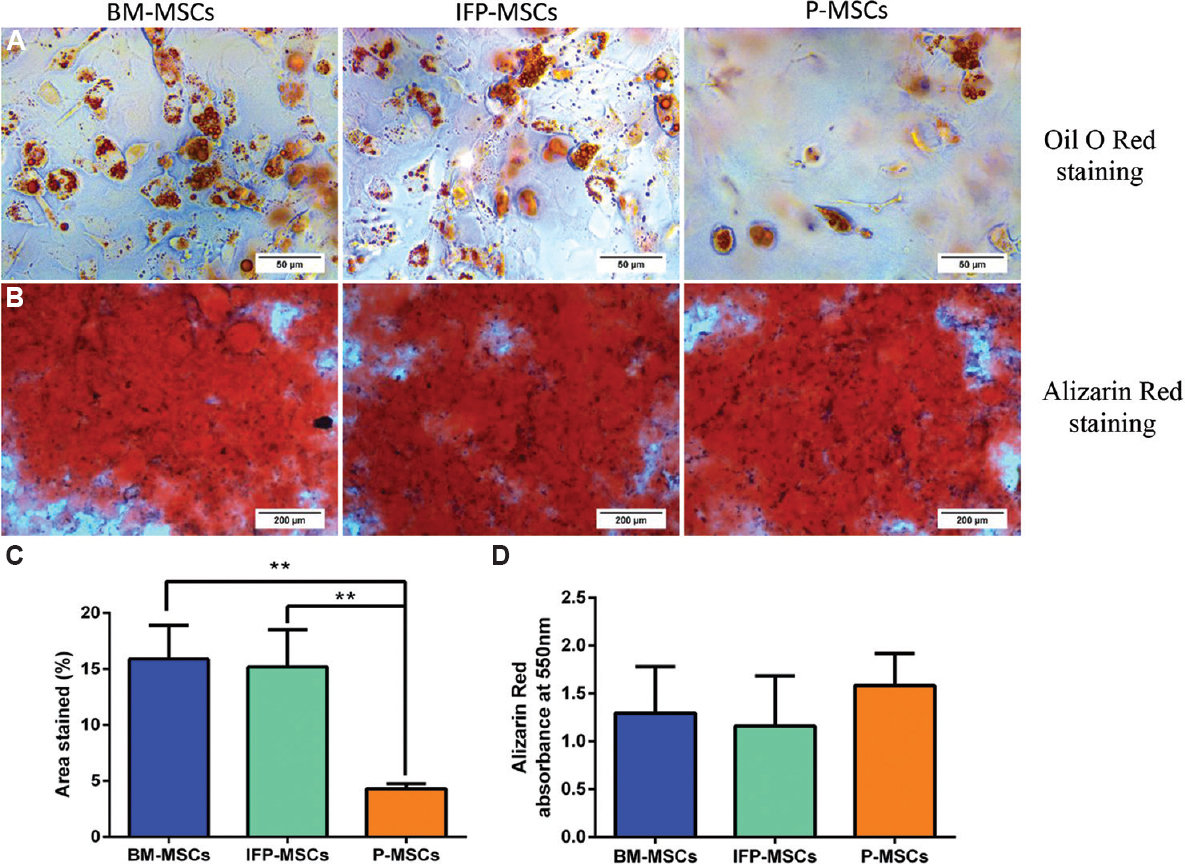 Adipogenic and osteogenic differentiation potential of MSCs from three sources. (A) Oil O Red staining showed lipid droplet formation in BM- MSCs, infrapatellar fat pad- MSCs and P- MSCs. (B) Light microscopic images showed the calcium deposits stained with Alizarin Red staining. (C) Percentage of area stained with Oil Red O indicates BM- MSCs and infrapatellar fat pad- MSCs formed significantly higher lipid droplets than P- MSCs. P **<0.01. (D) Quantification of Alizarin Red staining indicates MSCs from all three tissues deposited similar amount of calcium with no significant difference. MSC, mesenchymal stem cells.