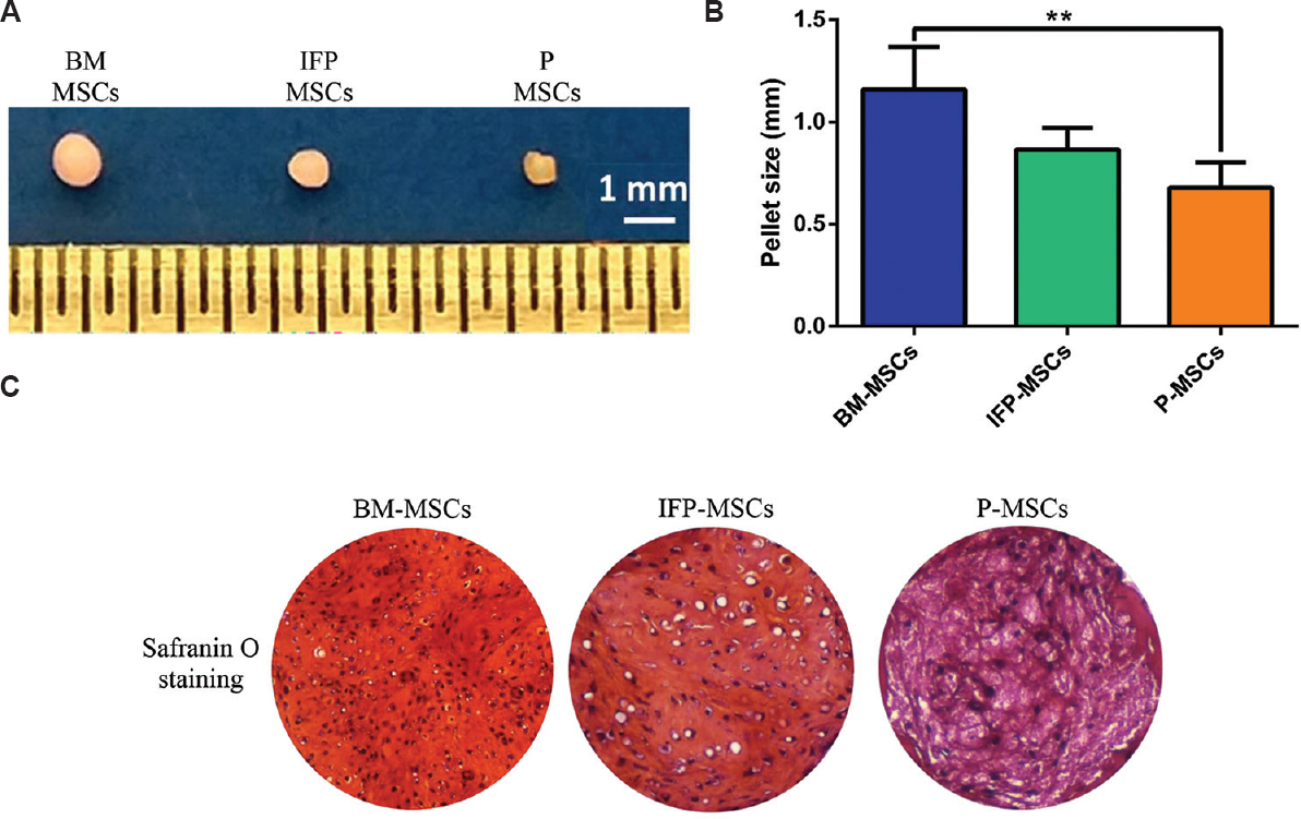 Chondrogenic differentiation of MSCs from three sources. (A) The photograph represents the gross appearance of cartilage pellets derived from three MSC sources with a scale (1-cm markings) showing the BM- MSCs generated the largest size pellet. (B) Cross-sectional measurement confirmed that BM- MSCs had a significantly thicker cartilage than P- MSCs. (C) Light microscopic images (×10) illustrate Safranin O staining of cartilage pellets showed profuse matrix deposition in BM- MSCs compared to IFP-P-MSCs. P **<0.01. IFP-P-MSCs, infrapatellar fat pad and periosteum- MSCs.