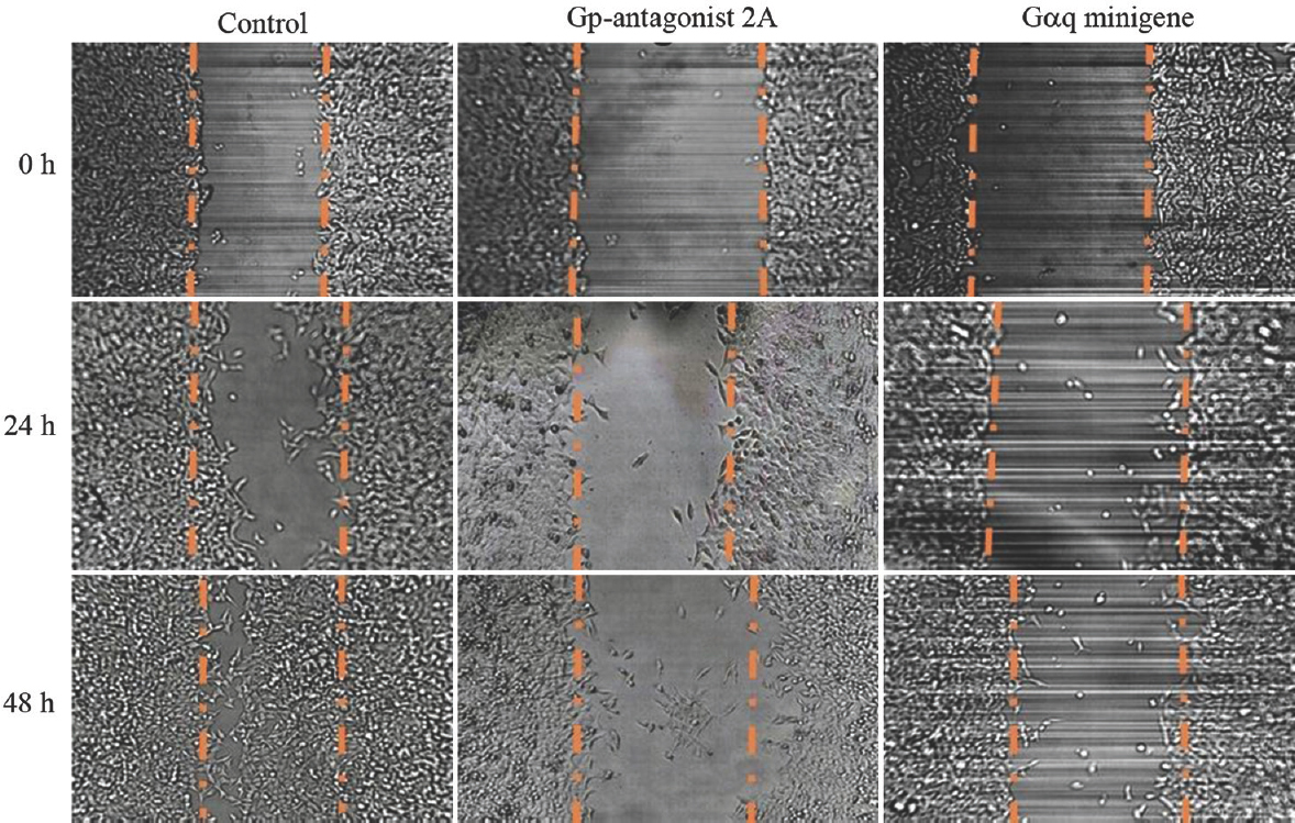 Inhibitors of Gq signalling decrease migration of SW480 cells. The figure represents the results of wound-healing experiments.