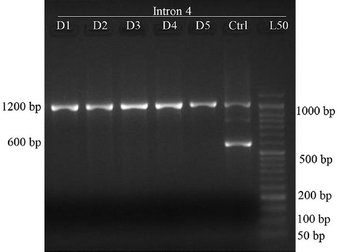PCR-sequence specific priming products for intron 4 region of RHD gene (n=200). D1-D5 shows reaction of five donor samples using primer set A1-A2, Ctrl-control sample (DNA from known RhD-positive individual was used as control), L50 - 50 bp DNA ladder. Band at 1200 bp is a product of RHCE gene while band 600 bp is the product from intron region of RHD gene. None of the five samples shown in the image carried intron 4 region of the RHD gene while both the bands were observed in the control sample.