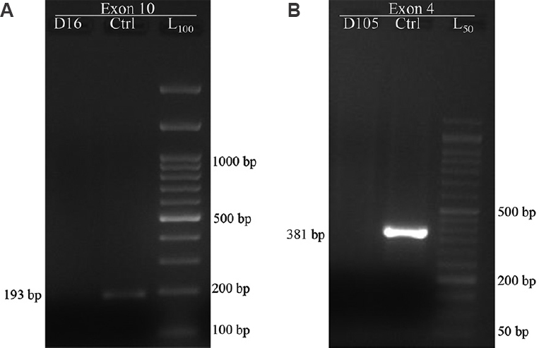 PCR-sequence specific priming products for exon 10 region and normal / RHDΨ segment in exon 4 region of RHD gene (n=200). L100 - 100 bp DNA ladder, L50 - 50 bp DNA ladder. Reaction with primer set B1-B2. (A) shows a 193 bp product in the control sample (Ctrl) and no product in donor sample (D61). Reaction with primer set C1-C2. (B) shows a 381 bp product obtained in control sample and no product in donor (D105) sample. Presence of pseudo gene (RHDΨ) would have resulted in a 418 bp product instead of 381 bp product seen in sample with normal RHD gene.