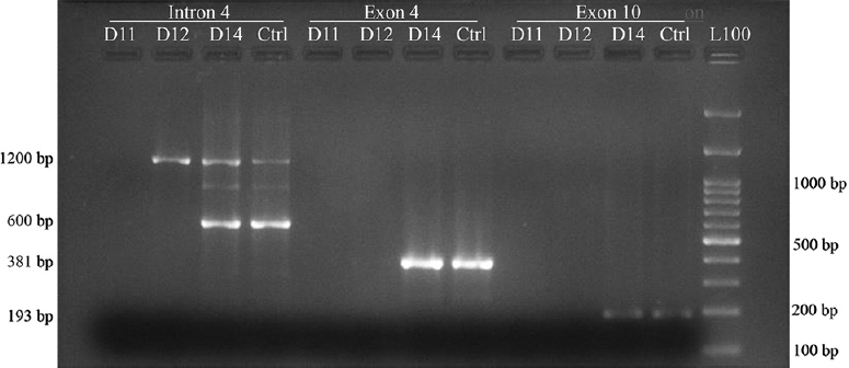 PCR-sequence specific priming and gel electrophoresis for presence of RHD gene in an individual with RhD-negative phenotype. L100 - 100 bp DNA ladder, L50 - 50 bp DNA ladder. Reaction of study samples (D11, D12, D14) with all three primer sets used in the study are shown here. D14 sample amplification resulted in all three products expected from a normal RHD gene as in the control sample (Ctrl) from normal RhD-positive individuals. Only 1200 bp products were observed for sample D12 representing amplification of region in the homologous portion of RHCE gene.