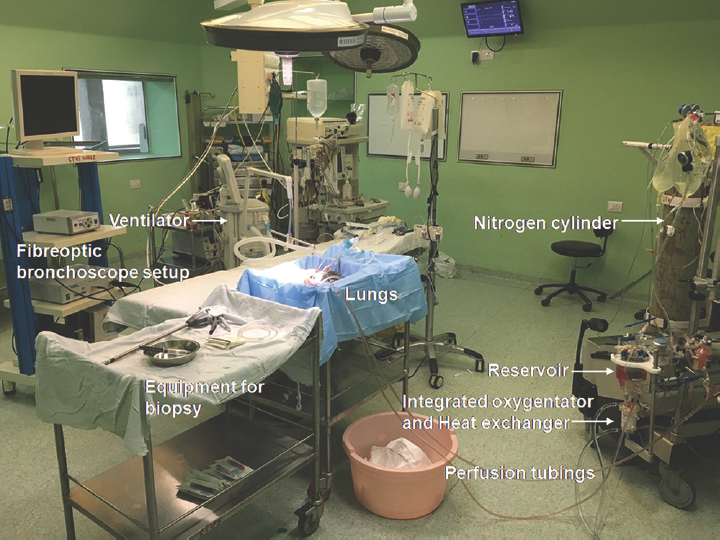 Ex vivo lung perfusion setup in the cardiac surgical operating room.