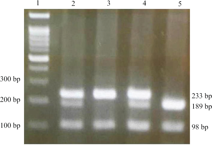 A pattern of agarose gel electrophoresis for FAS-670A/G variant determined by PCR-RFLP method, the PCR products were digested by MvaI enzyme. Lane 1: marker (50-bp DNA ladder); lanes 2 and 4: AG genotype (233, 189, 98 and 44 bp); lane 3: GG genotype (233 and 98 bp); lane 5: AA genotype (189, 98 and 44 bp). PCR-RFLP, polymerase chain reaction-restriction fragment length polymorphism.