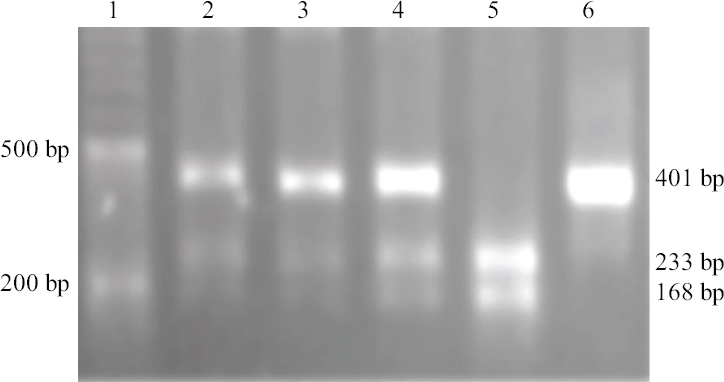 A pattern of agarose gel electrophoresis for FASL-844C/T variant determined by PCR-RFLP method. PCR products were digested by BsrDI enzyme. Lane 1: marker (50-bp DNA ladder); lanes 2, 3 and 4: CT genotype (401, 233 and 168 bp); lane 5: CC genotype (233 and 168 bp); lane 6: TT genotype (401 bp).