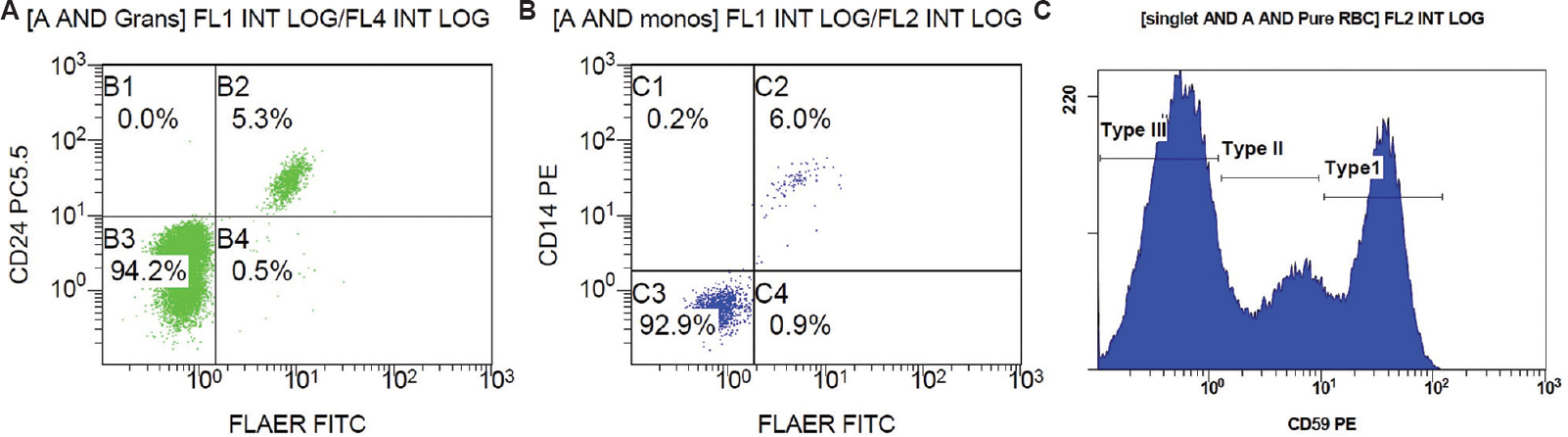 Scatter plot of patient A1: (A) FLAER and CD24 on granulocytes, (B) FLAER and CD 14 on monocytes, and (C) RBC histogram for expression of CD59 on CD235 a positive RBC. FLAER, fluorescein-labelled proaerolysin; CD, cluster of differentiation; RBC, red blood cells