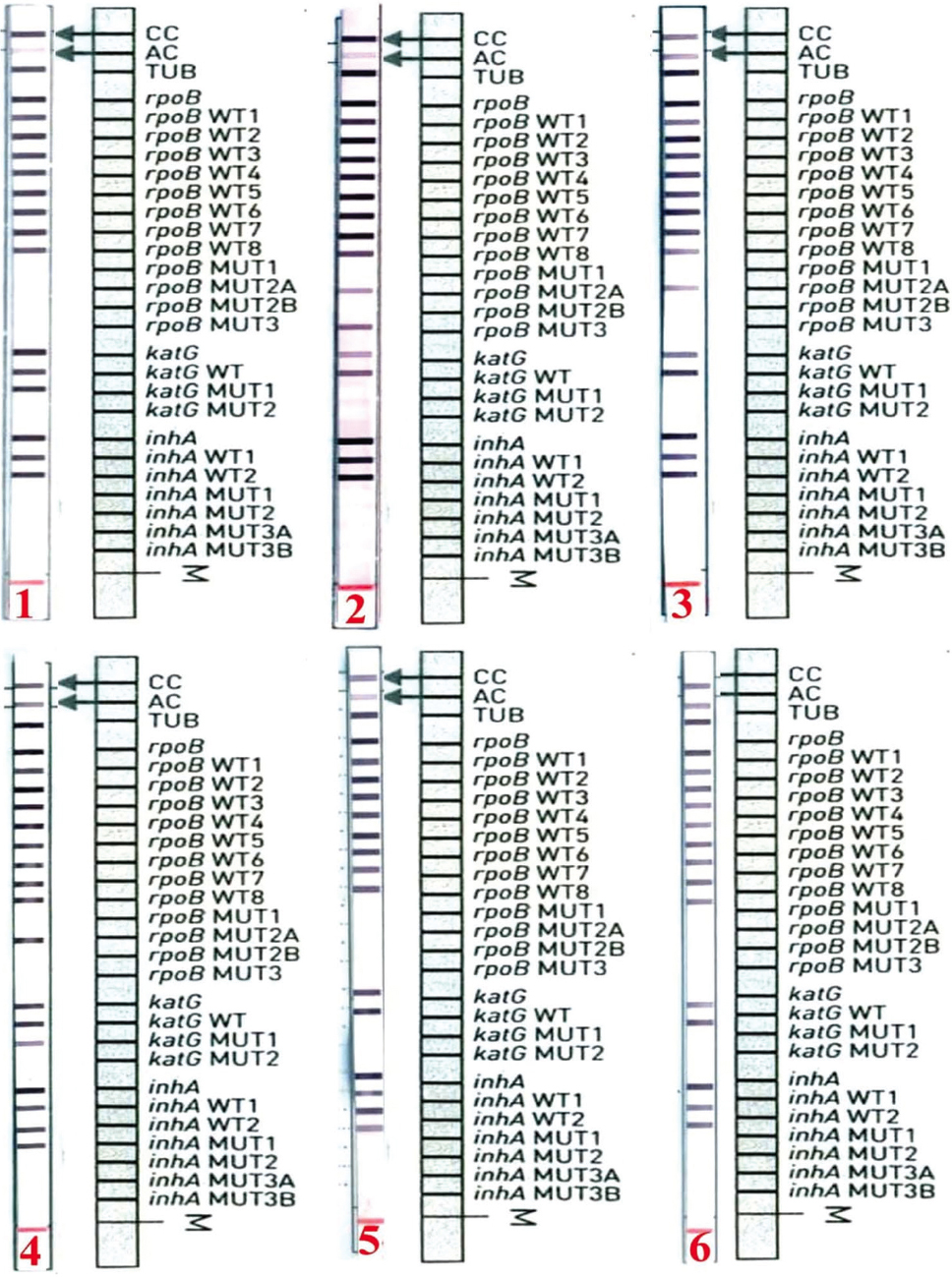 LPA strips shown here are representative of the years 2014 (strip 5), 2015 (strip 4), 2016 (strips 1 and 2), 2017 (strip 3) and 2018 (strip 6). The LPA strips 1 to 5 show the simultaneous presence of all WT as well as MUT band/s indicating heteroresistance in MTB strains. LPA strip 1 shows heteroresistance to katG gene, LPA strip 2 shows heteroresistance to the rpoB gene, LPA strip 4 shows heteroresistance to all three genes-rpoB, katG and inhA gene and LPA strip 5 shows heteroresistance to inhA gene. LPA strip 6 shows a sensitive band pattern of an MTB strain with the presence of all WT but no MUT band. LPA: line probe assay; WT: wild-type; MUT: mutation; MTB: Mycobacterium tuberculosis; CC: conjugate control; AC: amplification control; TUB: band specific to tuberculosis species.