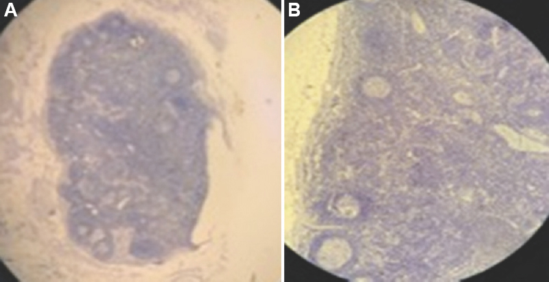 Photomicrographs showing capsulated lymph nodes with secondary follicles and germinal centres following IHC staining (cytokeratin cocktail, AE1/AE3) at (A) ×4, and (B) ×10 magnification. IHC, immunohistochemistry.