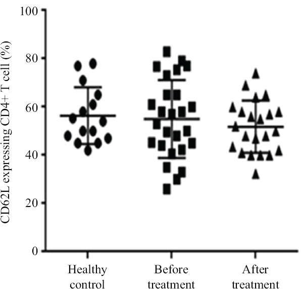 The frequency of CD62L-expressing CD4+ T-cells in ankylosing spondylitis patients before and after treatment with β-D-mannuronic acid and healthy controls.