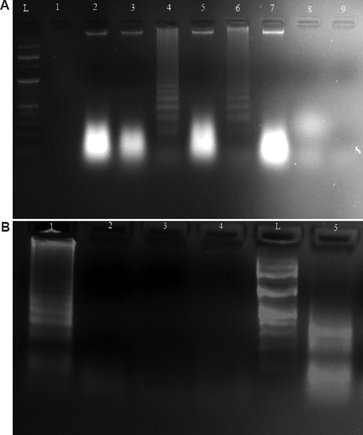 (A) Electrophoretic analysis of LAMP-amplified msrA gene in S. aureus at 65, 62 and 57ºC. (A) Lane L, 100 bp DNA ladder; Lanes 4 and 6, Characteristic ladder pattern at 65ºC; Lanes 2 and 5, Faint smear at 62ºC; Lanes 3 and 7, Faint smear at 57ºC; Lane 8, No characteristic pattern in E. coli; Lane 9, no template control; (B) Electrophoretic analysis of LAMP-amplified mphC gene in S. aureus at 65, 62 and 57ºC. Lane L, 100 bp DNA ladder; Lane 1, Characteristic ladder pattern at 65ºC; Lane 5, Ladder-like pattern at 62ºC; Lane 4, no characteristic pattern at 57ºC; Lane 3, No characteristic pattern in E. coli; Lane 2, no template control.