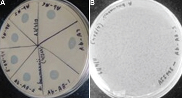 (A) Spot assay showing lysis of A. baumannii by different isolated Acinetobacter phages; AIIMS-Ab-A4, AIIMS-Ab-A5, AIIMS-Ab-A6, AIIMS-Ab-A7, AIIMS-Ab-A8-1, AIIMS-Ab-A8-2, and AIIMS-Ab-A8-3. (B) A representative picture showing plaques of Acinetobacter phage AIIMS-Ab-A8-3.