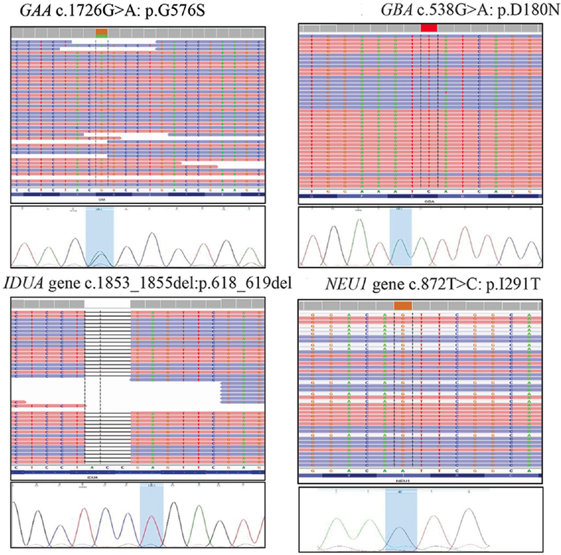 Representative examples of the variants identified through the study protocol in four different samples and thereafter validated through targeted Sanger sequencing.