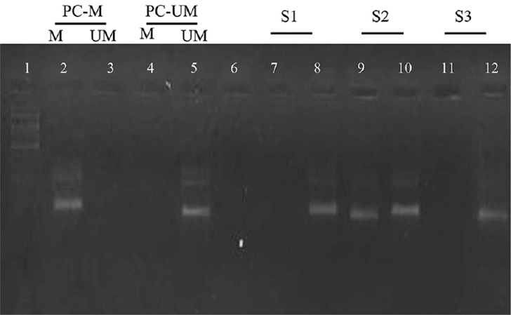 Analysis by MSP PCR of the promoter region of BRCA1. Lane 1 indicates 100 bp ladder, Lane 2: positive control for methylated DNA; Lane 5: shows positive control for unmethylated DNA, Lane 6: negative control; Lane 7-8, 9-10 and 11-12 shows clinical samples with results for methylated and unmethylated PCR, respectively. The presence of a visible PCR product in those lanes marked UM indicates the presence of unmethylated genes of BRCA1; the presence of a product in those lanes marked M indicates the presence of methylated genes. MSP PCR, methylation-specific PCR; BRCA1, breast cancer susceptibility gene 1