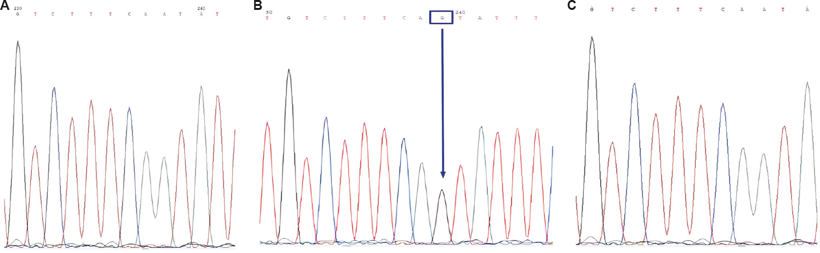 Confirmation of the CYP3A5*3 allele by the Sanger sequencing method. Each peak in electropherogram represents a single nucleotide in the DNA sequence. (A) sequencing of the sample with wildtype genotype (CYP3A5*1/*1), (B) sequencing of the mutant genotype (CYP3A5*3/*3) revealed a single base substitution of adenine with guanine (A>G) in intron 3, and (C) matched reference sequence. PCR, polymerase chain reaction.