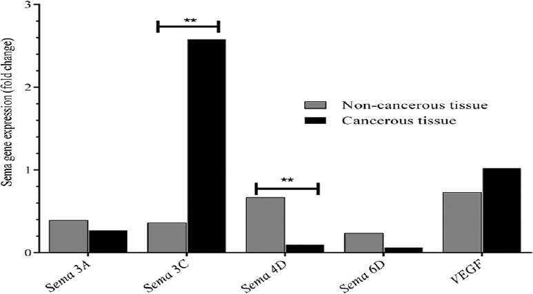 Transcripts level of semaphorins in LSCC individuals. Data are presented as median. Data are presented as fold change and β-actin housekeeping gene was used for gene expression normalization. LSCC, laryngeal squamous cell carcinoma; sema, semaphorins; VEGF, vascular endothelial growth factor (P**<0.01 vs. non-cancerous tissue).