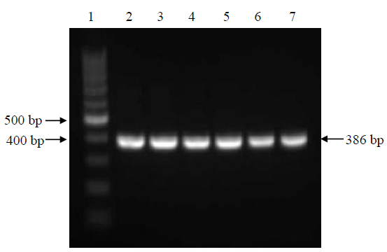 Representative gel electrophoresis picture of NS5B region amplified by semi-nested PCR (product size: 386 bp). Lane 1 is 100 bp DNA ladder and lanes 2–7 are samples. Bp, base pairs.