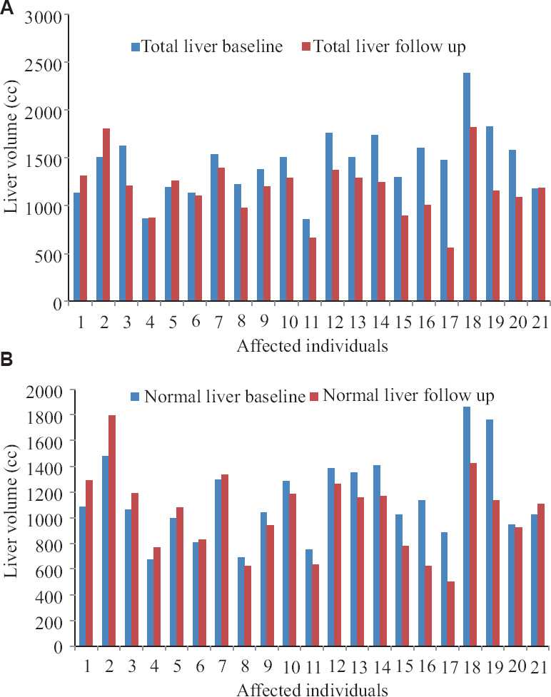 Change in (A) total and (B) normal liver volume (liver-GTV) on follow up scans after SBRT. GTV, gross tumour volume.