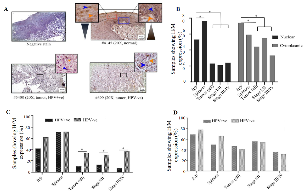 Immunohistochemical analysis of VHL protein in HPV+ve/–ve tumours and adjacent normal oral epithelium. (A) Representative image of the expression pattern (nuclear/cytoplasmic) of VHL in different layers (B/P and spinous layers) of adjacent normal epithelium and HPV+ve/HPV–ve tumour tissue samples. The insets are showing high-power view of the respective image. (B) Bar graph represents H/M expression of VHL in nuclear and cytoplasmic compartments in different layers of adjacent normal and tumours tissues of different clinical stages, irrespective of HPV infection status. (C and D) The bar graphs represent HPV infection specific comparative expression pattern of VHL in nuclear and cytoplasmic compartments in different layers of adjacent normal and tumours tissues of different clinical stages. Blue and orange arrows indicate nuclear and cytoplasmic expression, respectively and grey gradient triangle indicates nuclear/cytoplasmic expression pattern (P* <0.05).