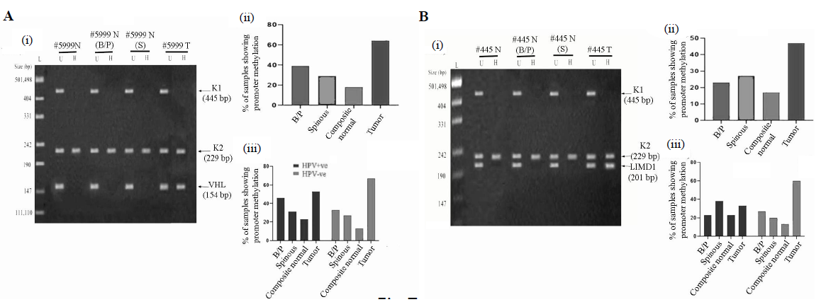 Promoter methylation analysis of VHL and LIMD1 genes in HPV+ve and HPV–ve samples. (A & B); Panels (i) Representative gel image of promoter methylation analysis using MSRA method for B/P and spinous layers, whole normal (composite) and its corresponding tumour samples. (ii) The bar graph represents the methylation frequency of the genes in different layers of normal oral epithelium, composite normal and corresponding HNSCC tissue samples irrespective of their HPV infection status. (iii) The bar graph represents HPV infection specific methylation frequencies of the genes in the same set of samples. U, undigested samples; H, HpaII digested samples.