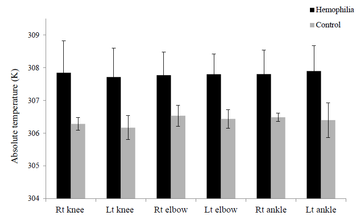 Baseline comparison of avg. Tmax between haemophila affected individuals and controls. The bar-graph compares the avg. Tmax. for the bilateral joints in both the groups. Joints in haemophila affected individuals show significantly (P<0.05) high temperature in all the three types of joints as compared to controls. Rt, right; Lt, left.