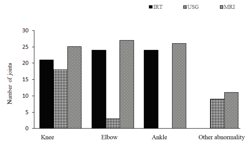 Joint bleeding detected by IRT, USG and MRI. Results of IRT, USG and MRI is shown as composite bar-diagram. IRT of 69 joints had ΔTmax >0.5K, USG detected bleeding in 21 joints whereas MRI detected 78 joints with bleeding in total 288 joints screened. IRT, infrared thermography; USG, ultrasonography; MRI, magnetic resonance imaging.