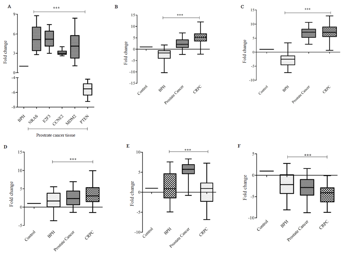 The expression analysis of Targetome of miR-363. (A) Target genes in prostate cancer tissue (n=48), (B) NRAS, (C) E2F3, (D) CCNE2, (D) MDM2, and (E) PTEN in BPH (n=60), prostate cancer (n=48), and castration resistant prostate cancer (CRPC) (n=25) as compared with healthy control (n=55). The NRAS, E2F3, CCNE2, and MDM2 gene was significantly upregulated in both tissue and serum while PTEN was significantly down-regulated (significant values P***<0.0001).