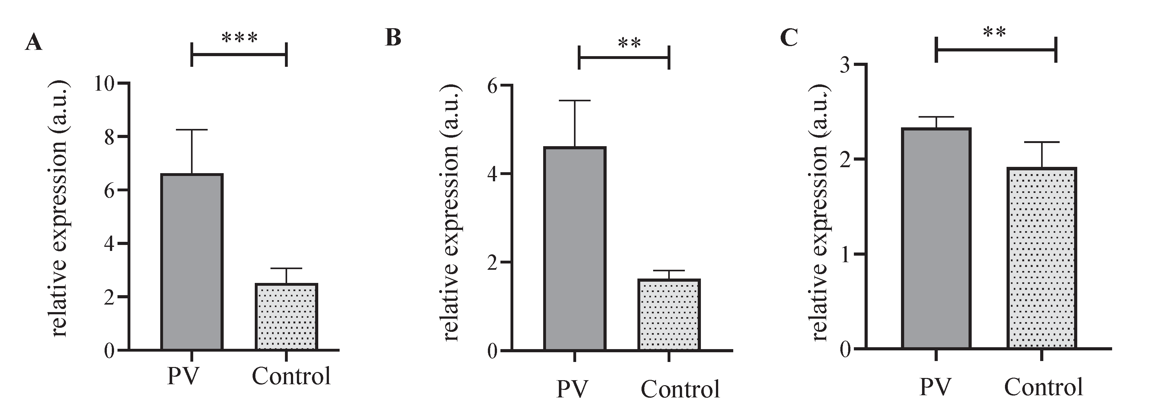 Iron and erythroid gene (A)TFRC; (B) FPN1B; and (C) KLF1 expression in reticulocytes of study participants with PV. Study participants with PV, and control group quantified using real-time PCR. The expression level was normalized to β-actin. TFRC (N=15,15), FPN1B (N=15,15), and KLF1 (N=15,15) (number of study participants with PV samples, controls, respectively) are shown.